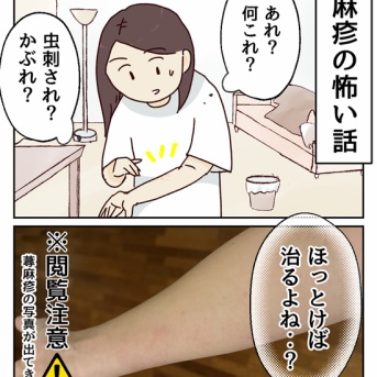 蕁麻疹の怖い話（閲覧注意⚠️蕁麻疹の写真出てきます）