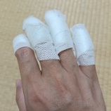 『ヤケドのケガの経過観察4※途中患部の写真もあるので閲覧にはご注意下さいませ。』の画像