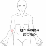 『野球肘による右肘の動作時の痛みと違和感　登別室蘭すのさき鍼灸整骨院　症例報告』の画像