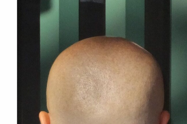 坊主男 スーパー坊主探偵団