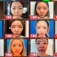 【画像】11回整形した姉ちゃん、12回目で究極の美を手に入れる