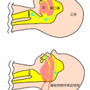 睡眠時無呼吸症候群が改善した話　前編