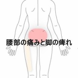 『動作時に増強する腰部全体のズキズキ痛と骨盤を立てる際の痛み　 登別室蘭すのさき鍼灸整骨院　症例報告』の画像