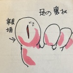 私が体験した抗がん剤の副作用の覚書と対策