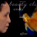 ～Dr.Fumiの美容Blog～