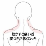 『両肩が挙がらず夜間痛もある五十肩 　登別室蘭すのさき鍼灸整骨院　症例報告』の画像