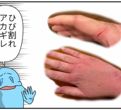 【やや閲覧注意】潔癖症が血を見る季節