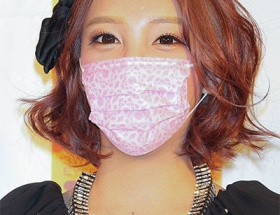 【悲報】ざわちん、小学生時代に「ゴキブリ」と言われいじめられる