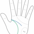 知能線は考え方の傾向を表す