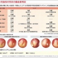 中耳炎抗生物質適応
