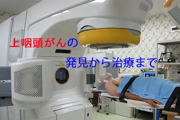 気まぐれkimokuの癌 上咽頭癌 闘病記 放射線治療の影響