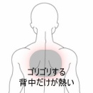 デスクワークで首から背中がゴリゴリする違和感 　登別室蘭すのさき鍼灸整骨院　症例報告