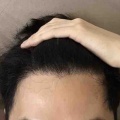 ９ヶ月経過