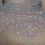 ちん毛 四年間毎日抜きまくった結果ｗｗｗｗｗｗｗｗｗｗｗｗｗｗｗｗｗｗｗｗｗｗｗｗｗｗｗｗｗ くるくるｖｉｐ