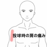 『フォロースルー期に右肩がズキッと痛む中学野球部員 　登別室蘭すのさき鍼灸整骨院　症例報告』の画像