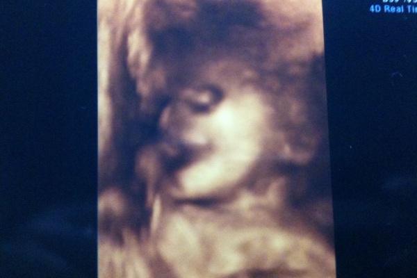 うさくま亭の子育て 食育エコ日記 10年09月