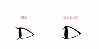 逆さまつげの手術を整形だと言い張る友人に引いた