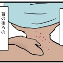 冬は首の後ろがかゆい