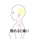 櫛を通すだけでも痛む左側頭部の神経痛様の痛み 　登別室蘭すのさき鍼灸整骨院　症例報告