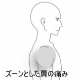 『重量物作業で生じた急性の肩の痛みとズーンとした鈍痛　 登別室蘭すのさき鍼灸整骨院　症例報告』の画像