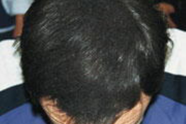 禿に福音か 希望の黒い粉スーパーミリオンヘアー 雑記ワイルド