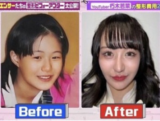 【超画像】現代の整形、ここまで綺麗になるｗｗｗｗｗｗｗｗｗ