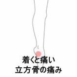 『ランニングで地面に足を着くと痛む右踵外側の痛み　登別室蘭すのさき鍼灸整骨院　症例報告』の画像