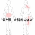 立ち仕事による左頸部・腰部・大腿部の痛みと緊張　登別室蘭すのさき鍼灸整骨院　症例報告
