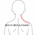 後ろに引っ張られるめまいと右頸部の緊張で仰向けに眠れない 　登別室蘭すのさき鍼灸整骨院　症例報告