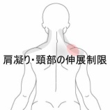 『デスクワークでズーンと重たい肩こり』の画像