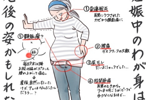 妊娠中のマイナートラブルを振り返る 尿漏れ Tomekkoの宝箱 3兄弟と好きなもの Powered By ライブドアブログ