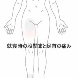 『寝ている間に悪化する股関節と足首の鈍痛　 登別室蘭すのさき鍼灸整骨院　症例報告』の画像