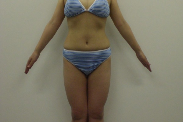 短期集中リフィート美脚作戦 ドラミの脚やせ挑戦日記