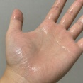 手掌多汗症はクソ