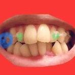 独身アラサー女の部分矯正体験記