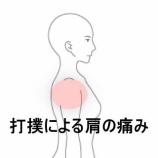 『お風呂掃除中の転倒による肩の打撲と動作制限 登別室蘭すのさき鍼灸整骨院 症例報告』の画像
