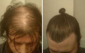 最近おっさんに流行ってるお団子長髪「マンバンヘア」、ガチでウケ悪かった「その年でワルっぽくされても」「今さらもてたいの？」