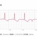不整脈（期外収縮）