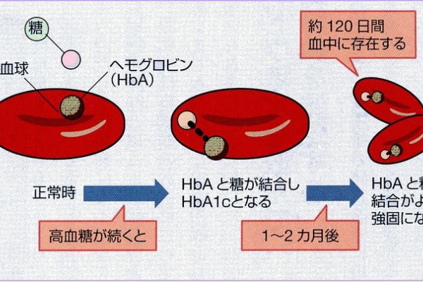 診療所の検査 Hba1c クリコヘモグロビン