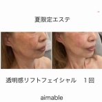 aimable　ｴﾏｰﾌﾞﾙ