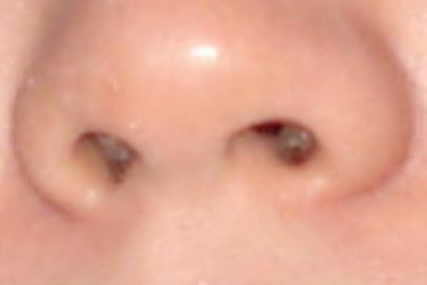 ひそやかな愉しみ 鼻毛