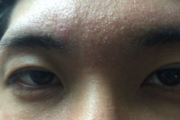 顔を洗わない美容挑戦