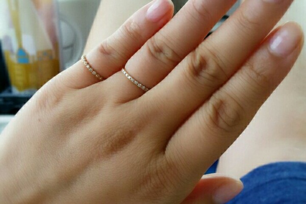 手湿疹 脱ステロイド そして角質培養