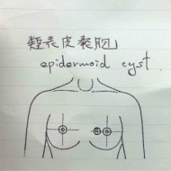 乳がん検診で生体検査をしたお話5