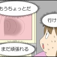 大腸の中にいるポリープ④