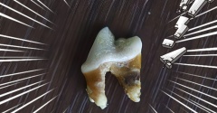 【歯医者さんの日】まりちゃんの歯、とうとう