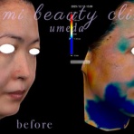 ～Dr.Fumiの美容Blog～