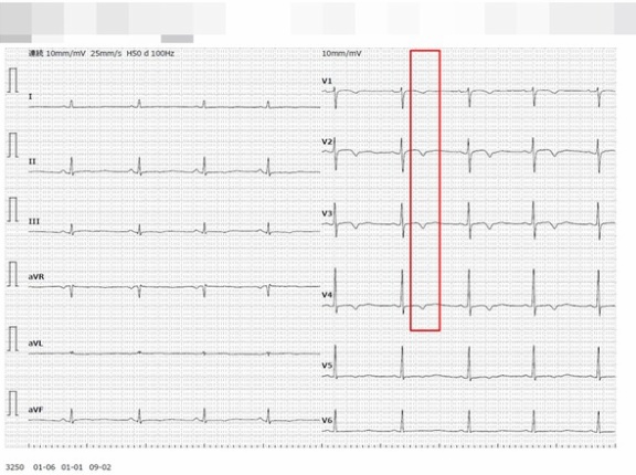【50代主婦】初めての心臓エコー検査（後編）「心電図異常」と言われた結果は…！？