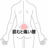 『立ち仕事による腰椎下部の動作時痛 　登別室蘭すのさき鍼灸整骨院　症例報告』の画像