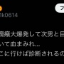 母親「長男やばい。癇癪大爆発して次男と目が合っただけで顔面引っ掻いて血まみれ…捨てたい」